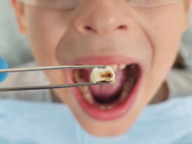 Best Tooth Infection Emergency Dentist  in New River, AZ